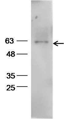 Anti-Aromatase/CYP19A1 Polyclonal Antibody 2
