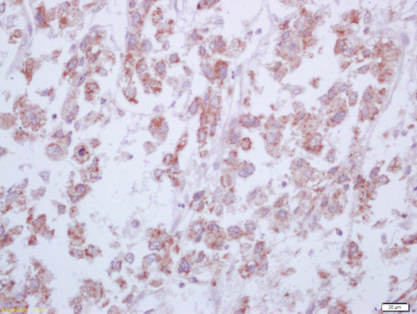 Anti-Arginase 1/ARG1 Polyclonal Antibody 2