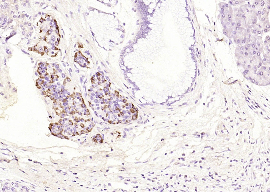 Anti-BCL2 Antibody (5A806)