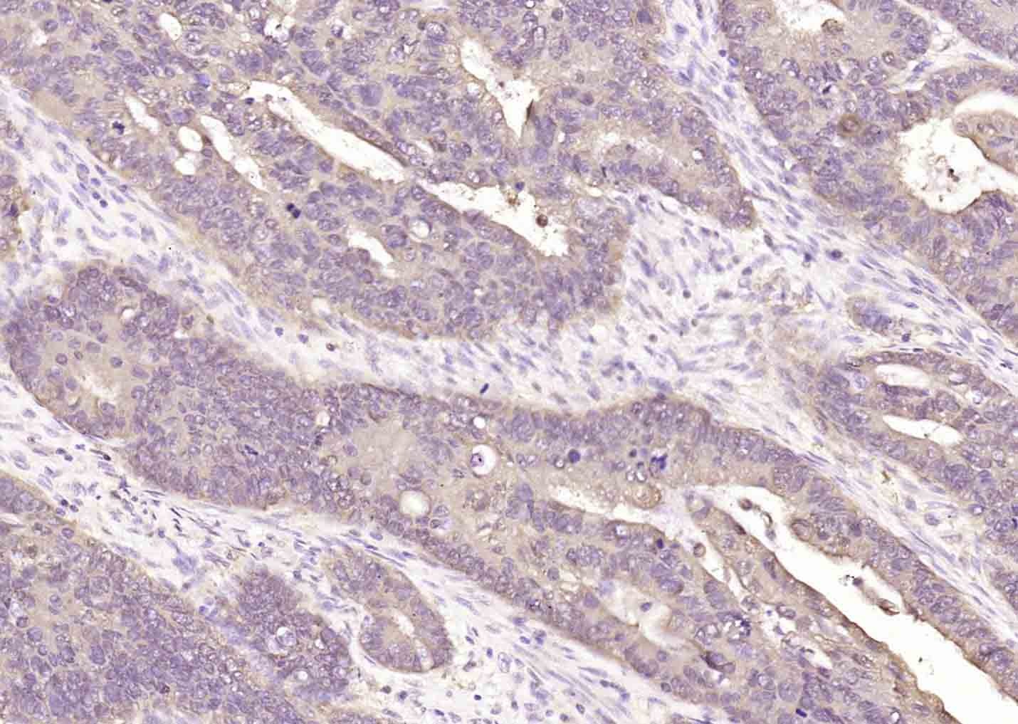 Anti-BCL2 Antibody (2P100)