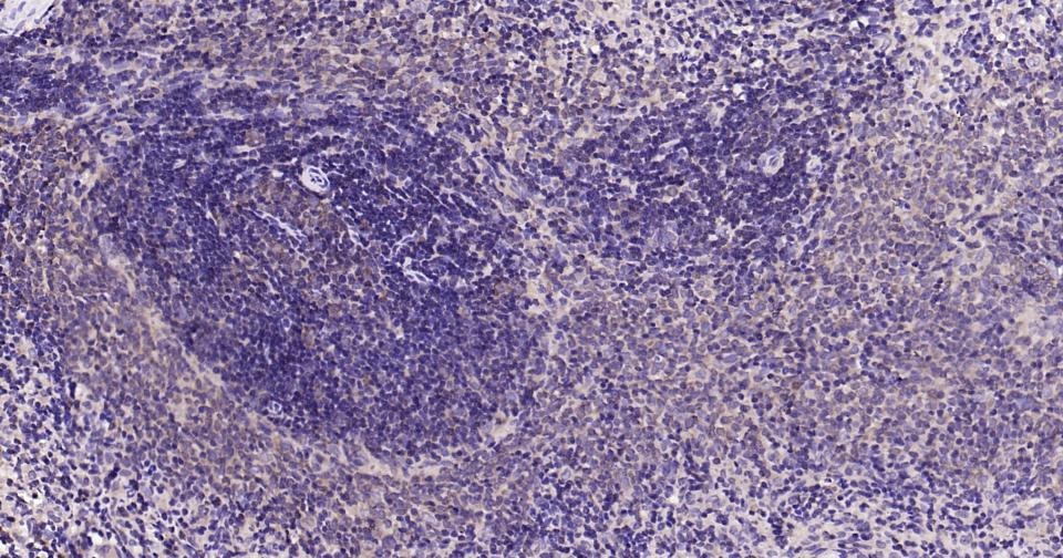 Anti-BAX Antibody (5X827)