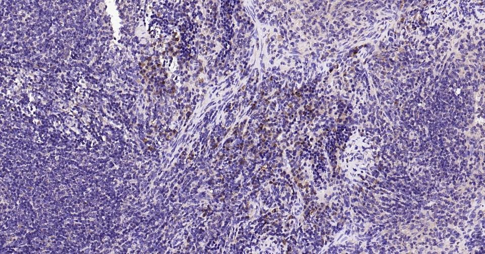 Anti-BAX Antibody (5X827)