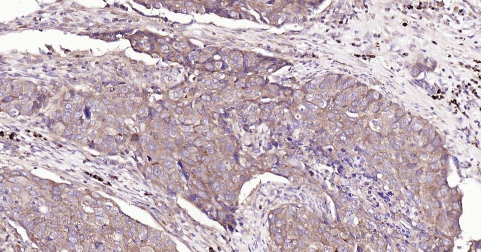 Anti-BAX Antibody (5X827)