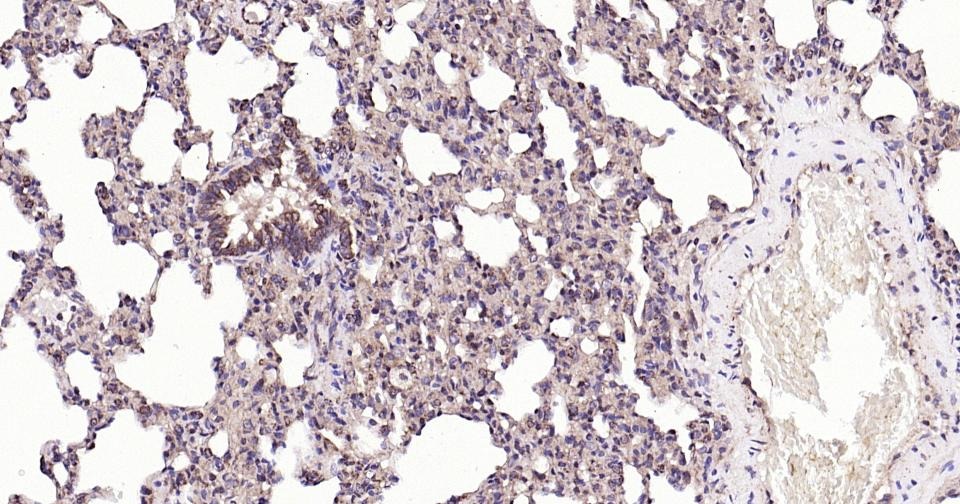 Anti-BAX Antibody (5X827)