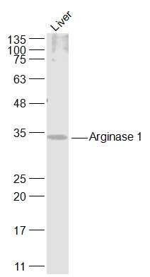 Anti-Arginase 1/ARG1 Polyclonal Antibody