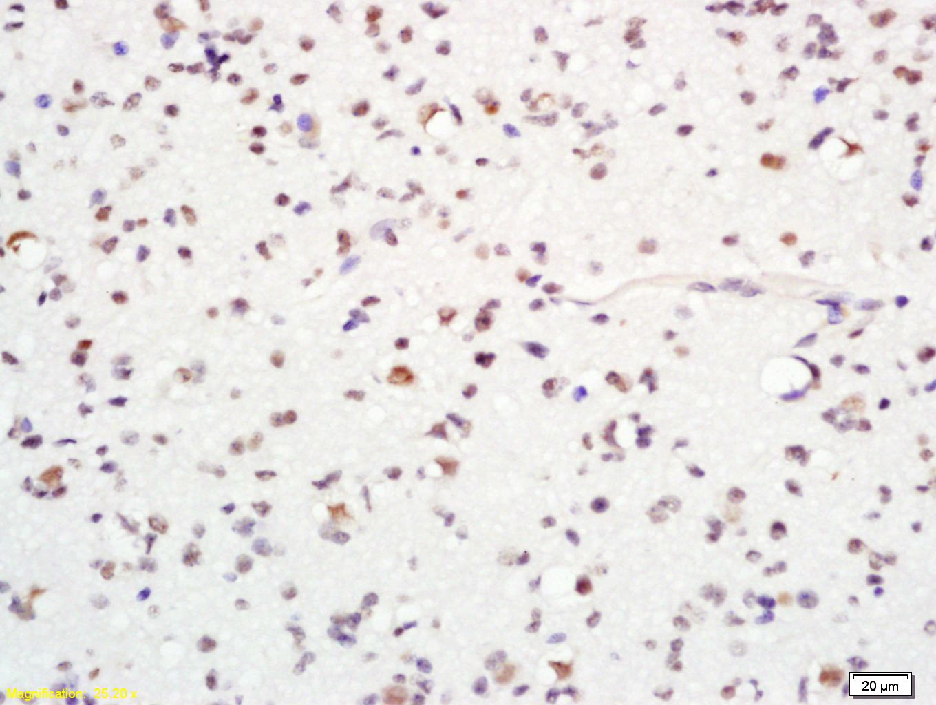 Anti-ASCL1 Polyclonal Antibody