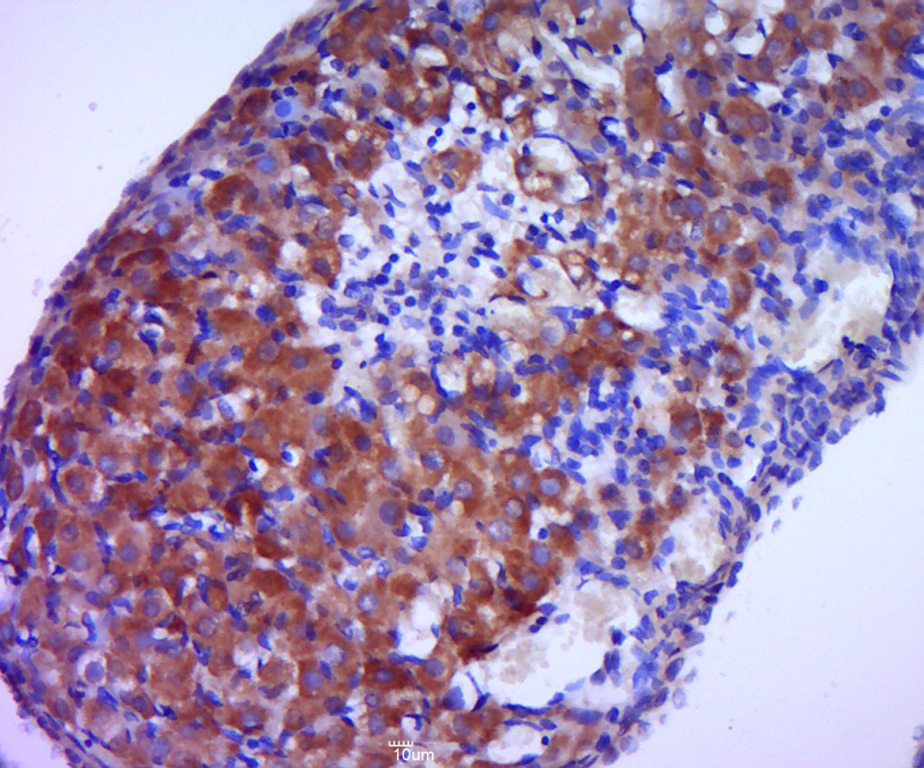 Anti-Aromatase/CYP19A1 Polyclonal Antibody