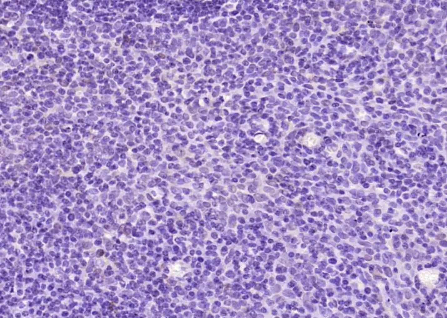 Anti-BCL2 Antibody (2P100)