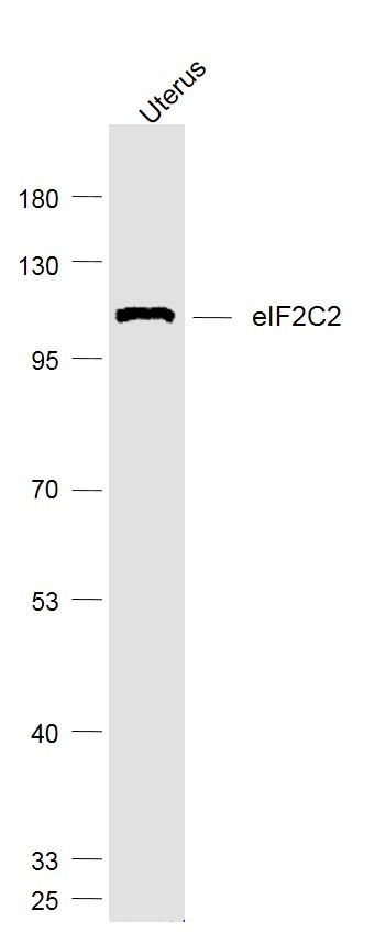 Anti-Argonaute-2 Polyclonal Antibody