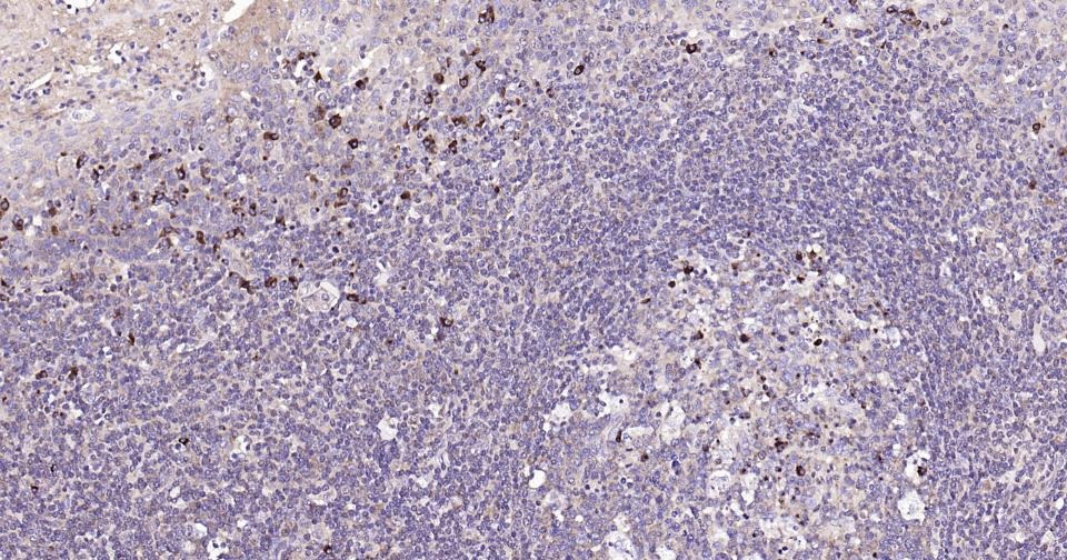 Anti-BAX Antibody (5X827)