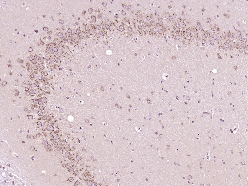 Anti-BAX Polyclonal Antibody 2