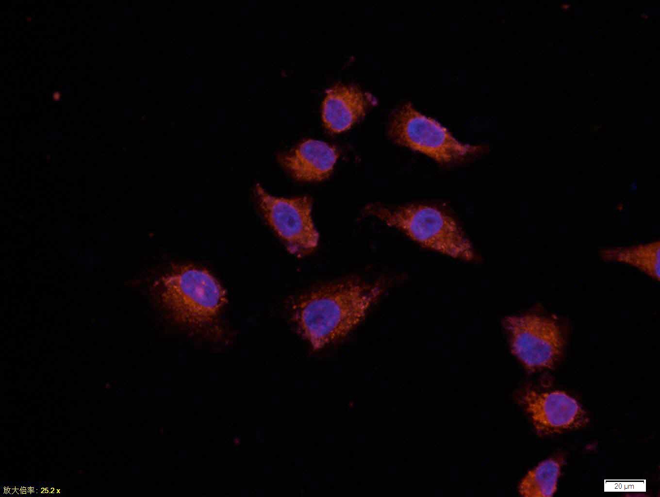 Anti-BCL2 Antibody (5A806)