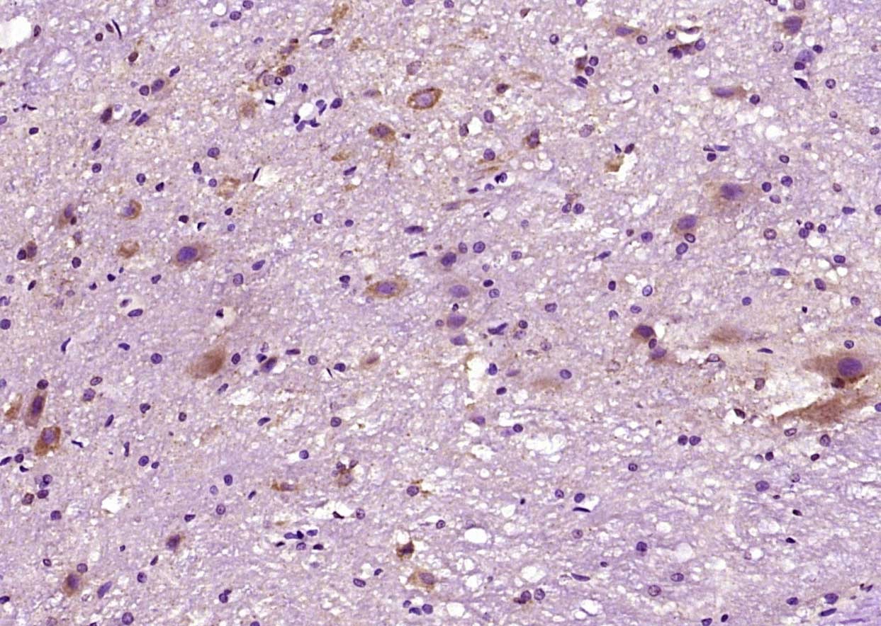 Anti-BAX Polyclonal Antibody 2