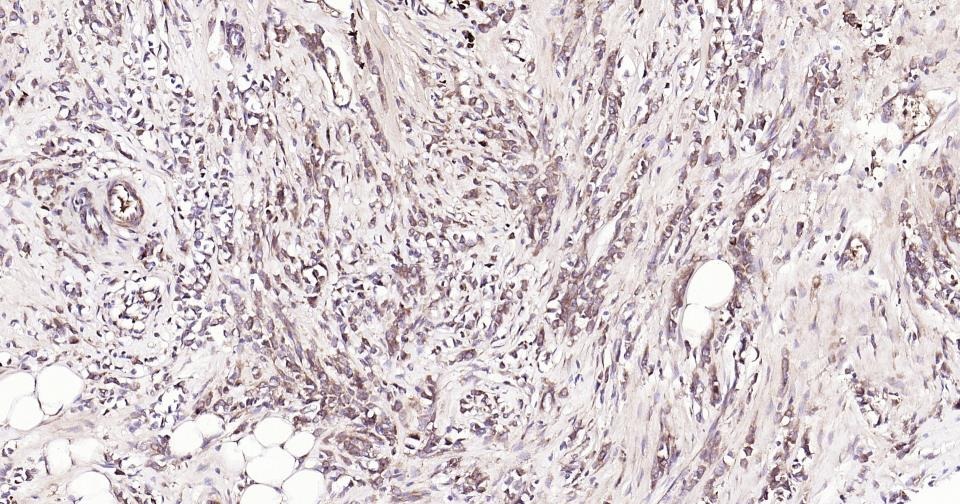Anti-BAX Antibody (5X827)