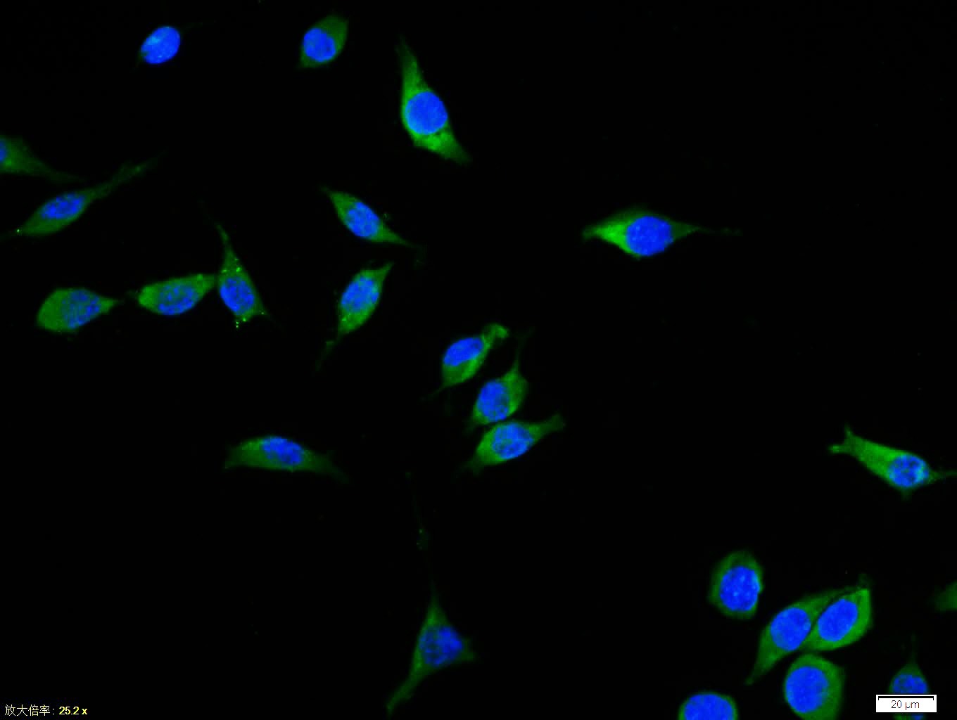 Anti-BAX Polyclonal Antibody 2