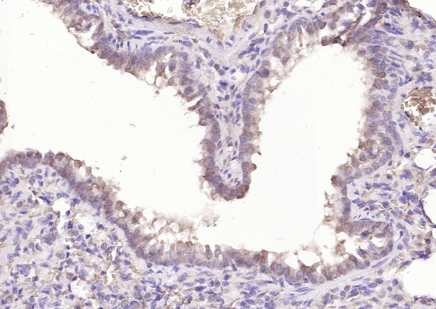 Anti-BCL2 Antibody (5A806)