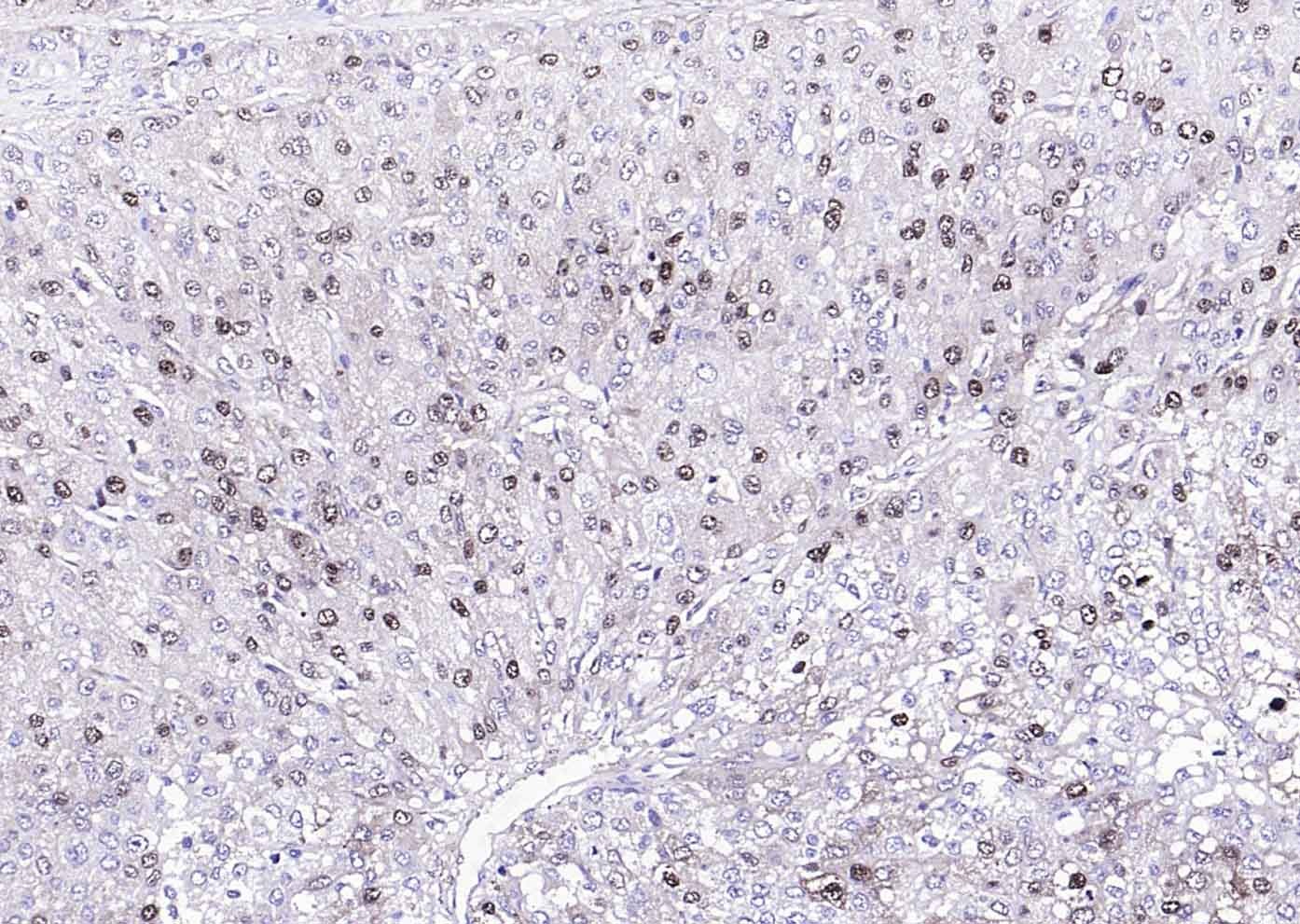 Anti-Arginase 1/ARG1 Polyclonal Antibody 2