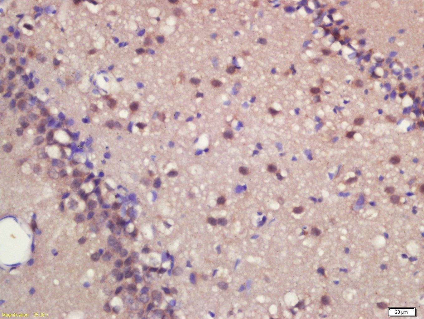 Anti-ASCL1 Polyclonal Antibody