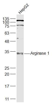 Anti-Arginase 1/ARG1 Polyclonal Antibody