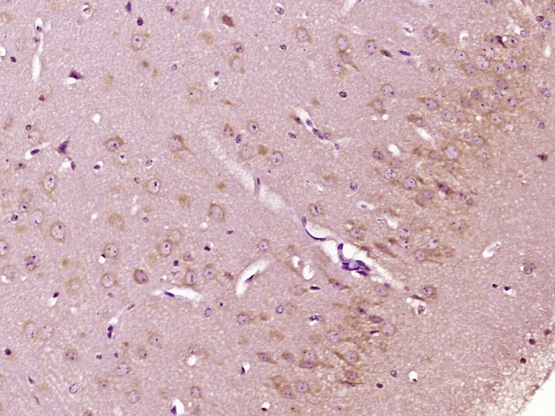 Anti-BCL2 Polyclonal Antibody