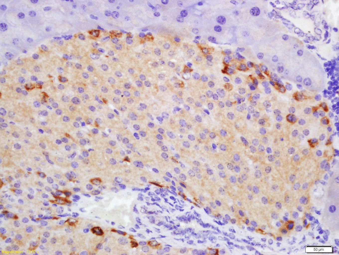 Anti-ATG1 Polyclonal Antibody