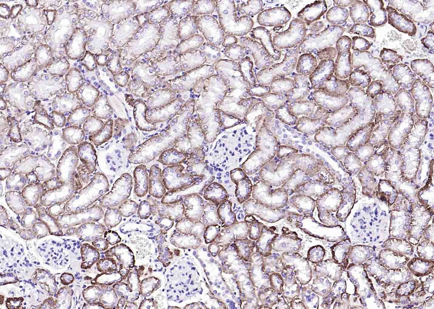 Anti-ATP1A1 Polyclonal Antibody 2