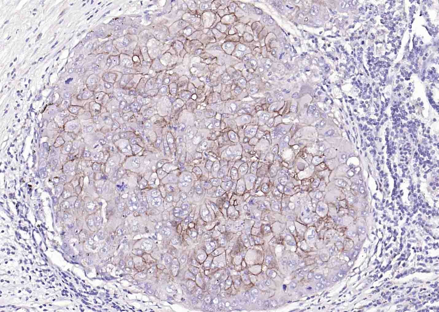 Anti-ATP1A1 Polyclonal Antibody 2