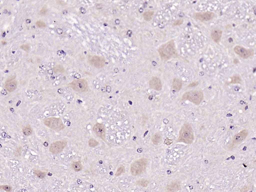 Anti-ATF-6 Polyclonal Antibody