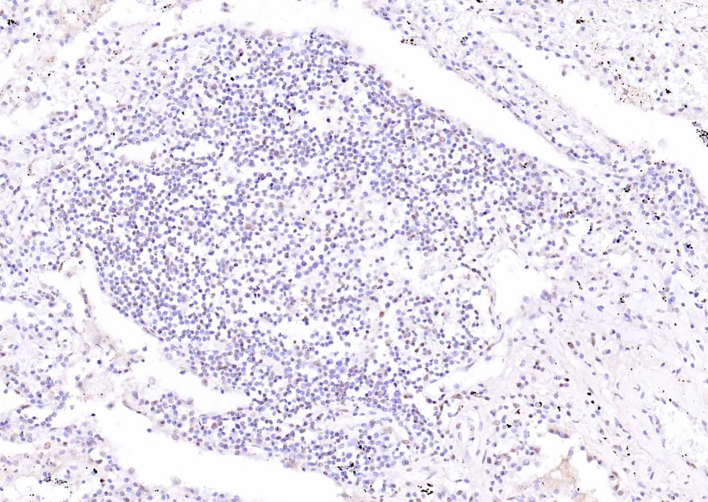 Anti-ATF-4 Polyclonal Antibody