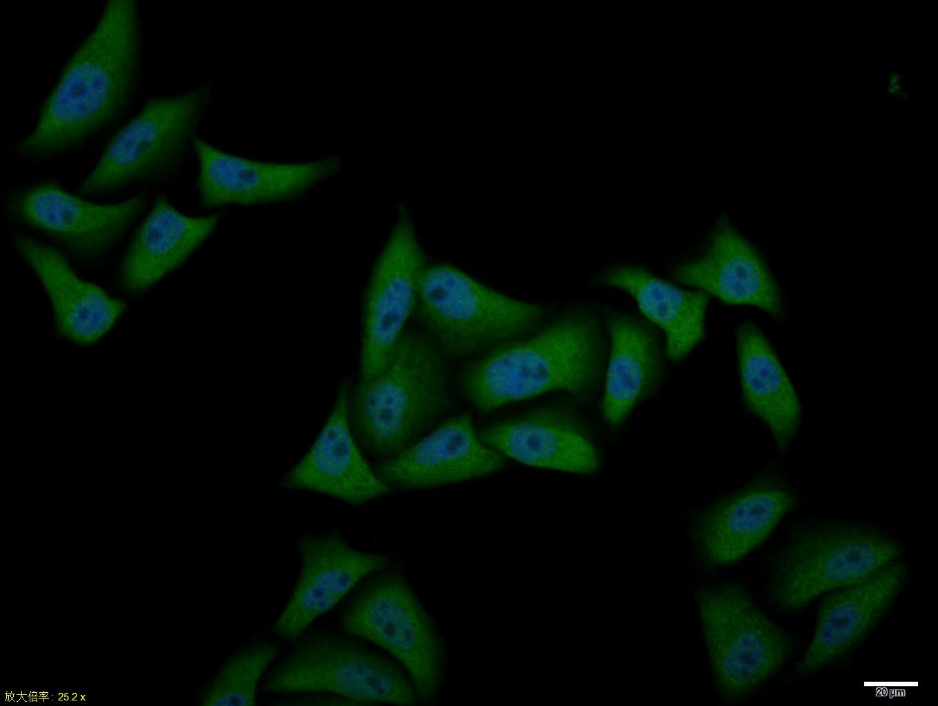 Anti-ATF-4 Polyclonal Antibody