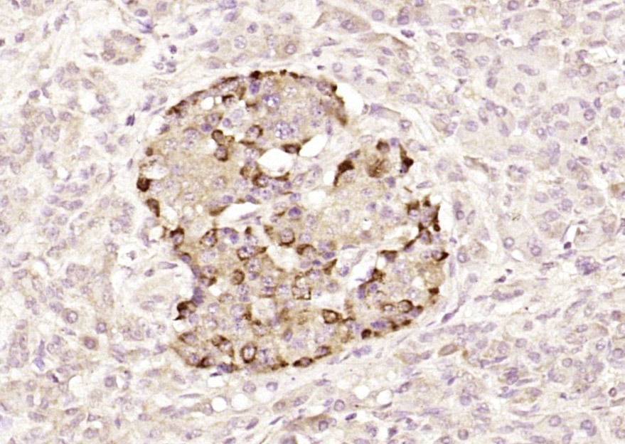 Anti-BCL2 Polyclonal Antibody