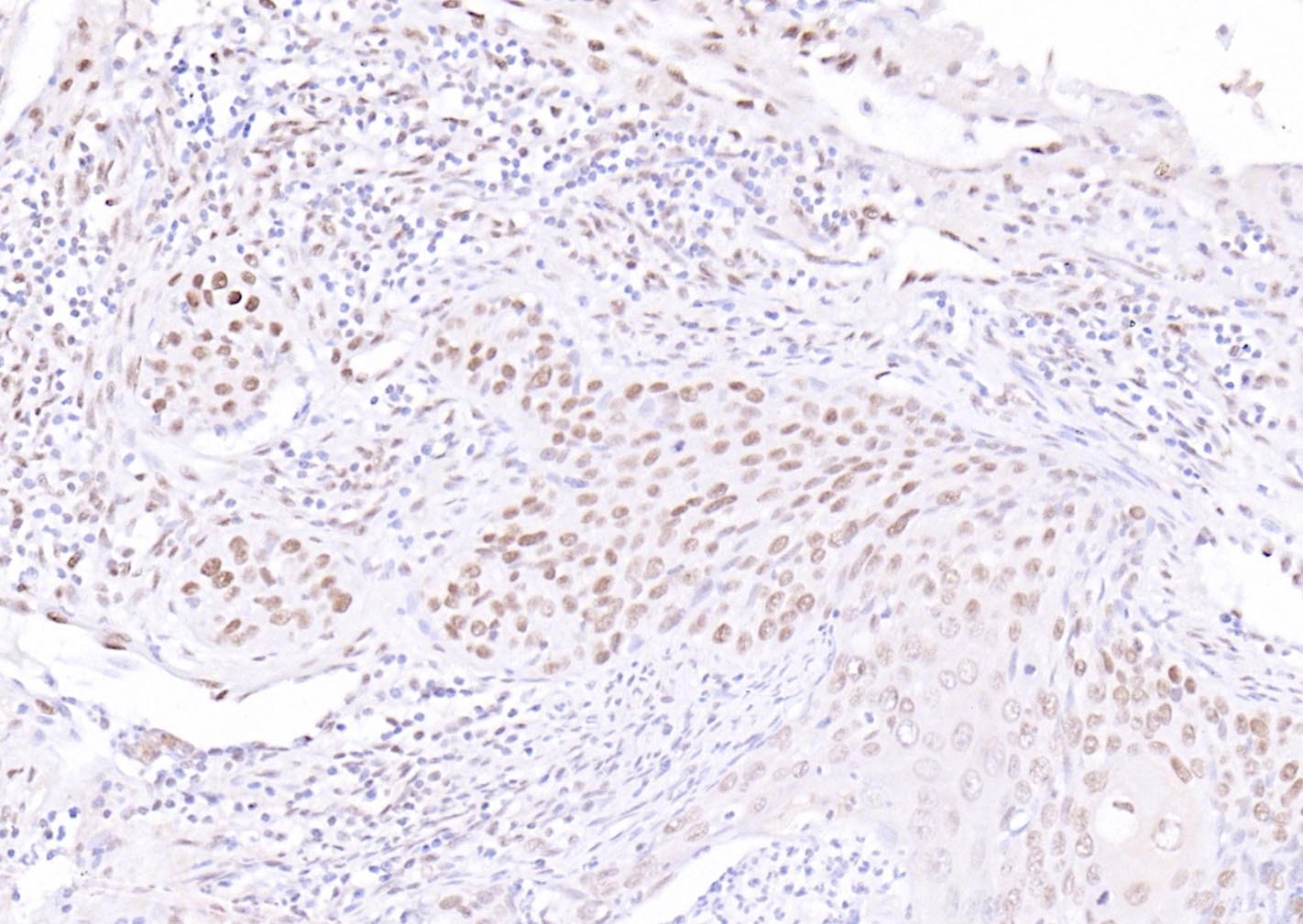 Anti-ATF-4 Polyclonal Antibody