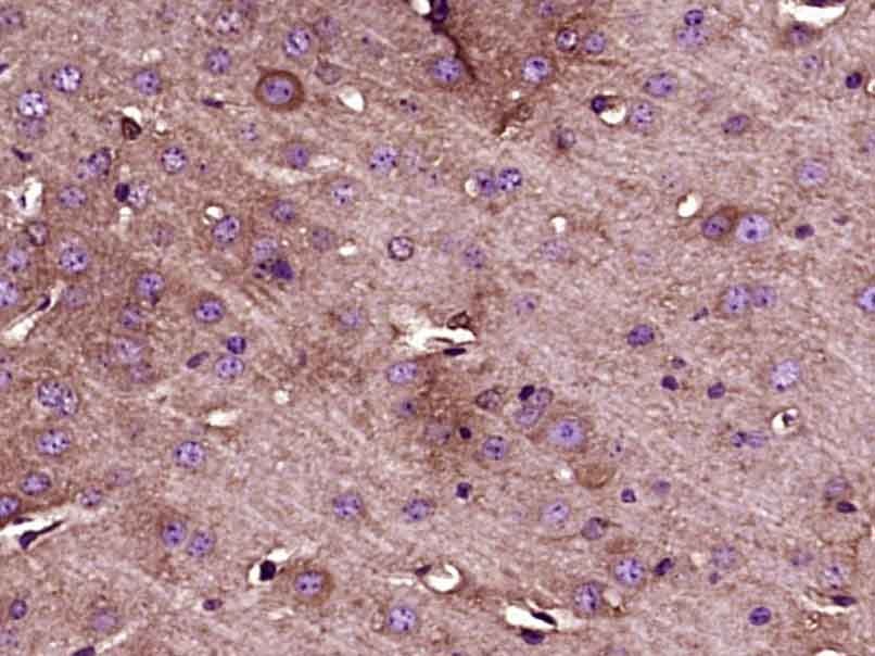 Anti-ATG5 Polyclonal Antibody