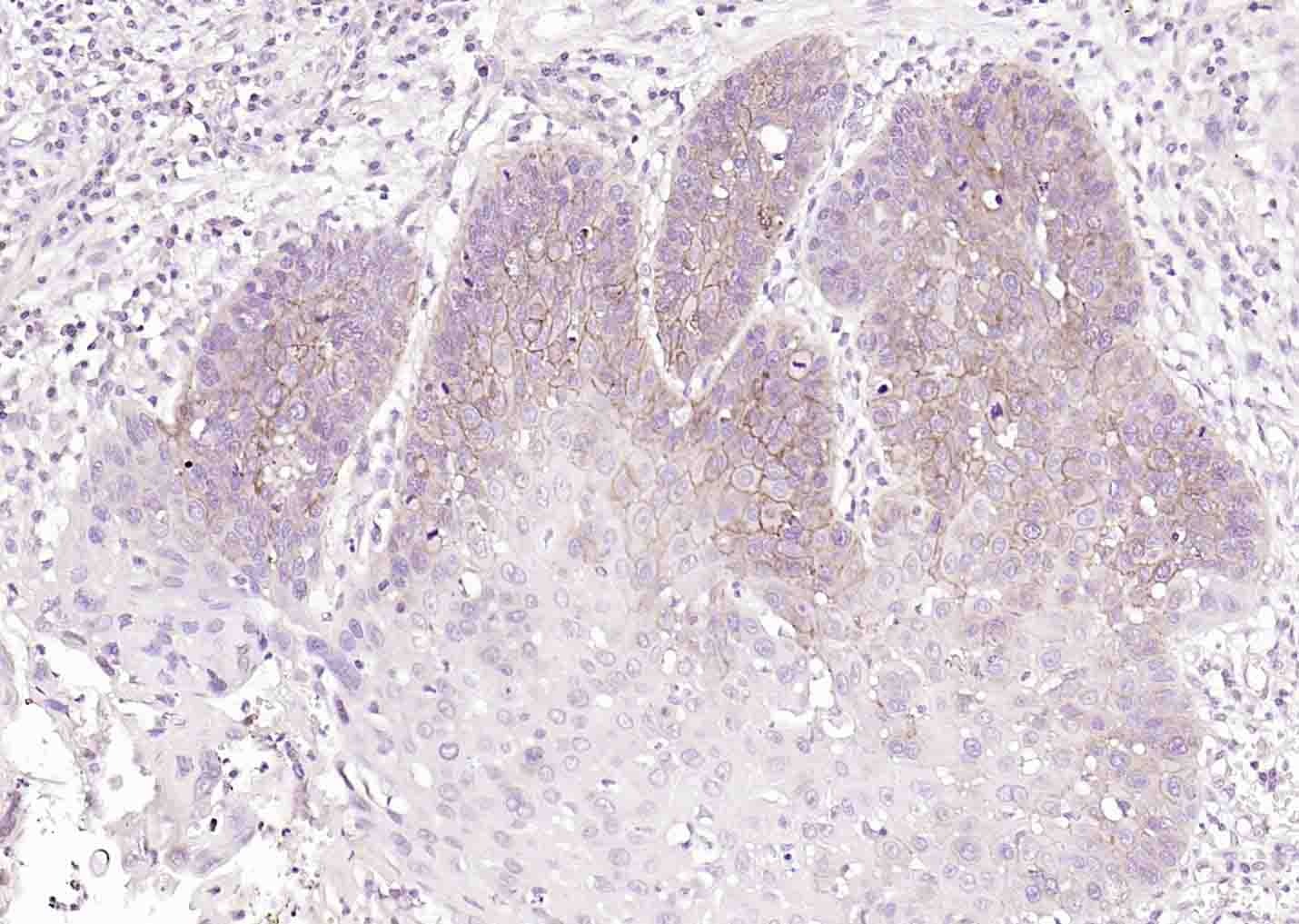 Anti-ATP1A1 Polyclonal Antibody 2