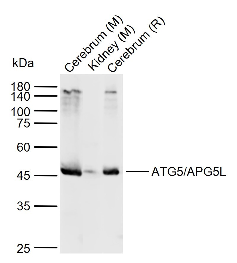Anti-ATG5 Polyclonal Antibody