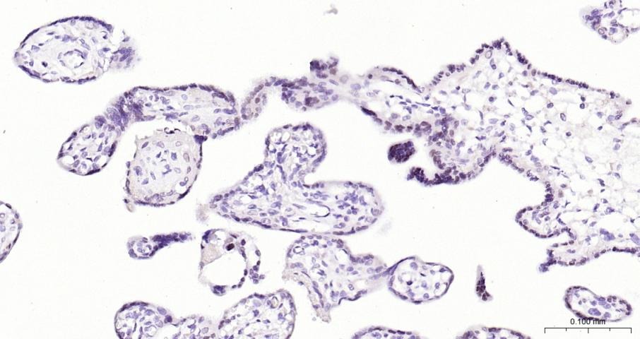 Anti-ATF-3 Polyclonal Antibody