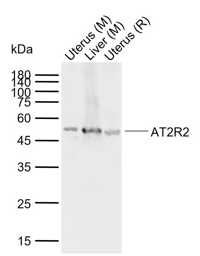 Anti-AT2R2 Polyclonal Antibody