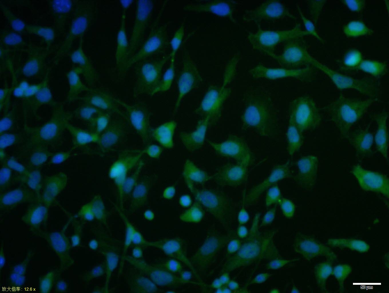 Anti-ATF-4 Polyclonal Antibody
