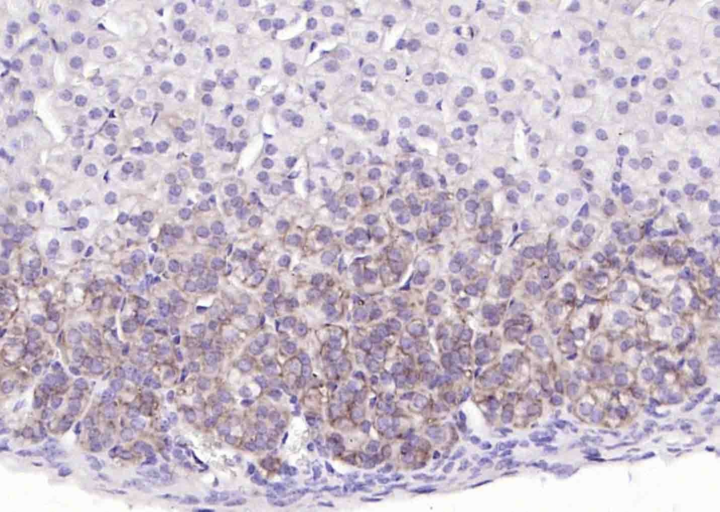 Anti-ATP1A1 Polyclonal Antibody 2