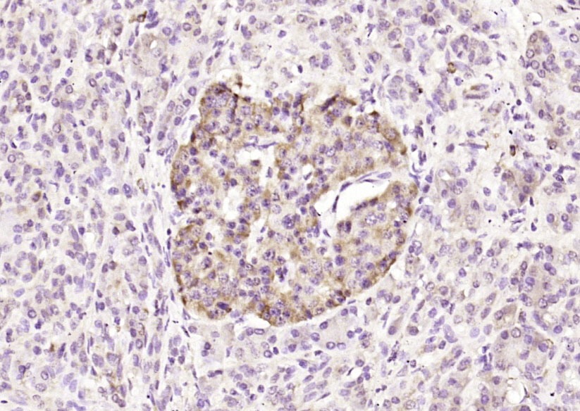 Anti-BCL2 Polyclonal Antibody