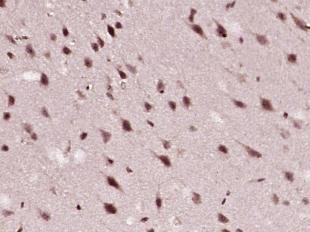 Anti-ATF-6 Polyclonal Antibody