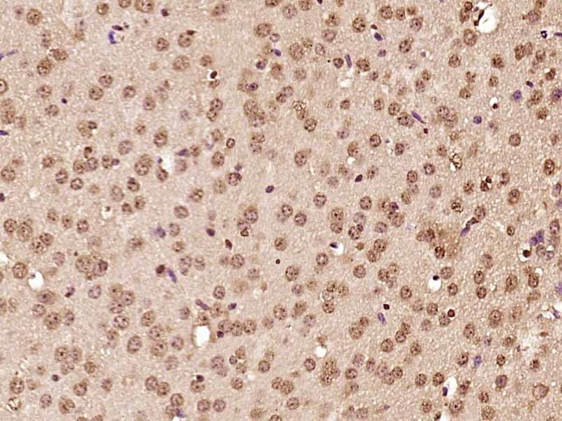 Anti-ATF-6 Polyclonal Antibody 2
