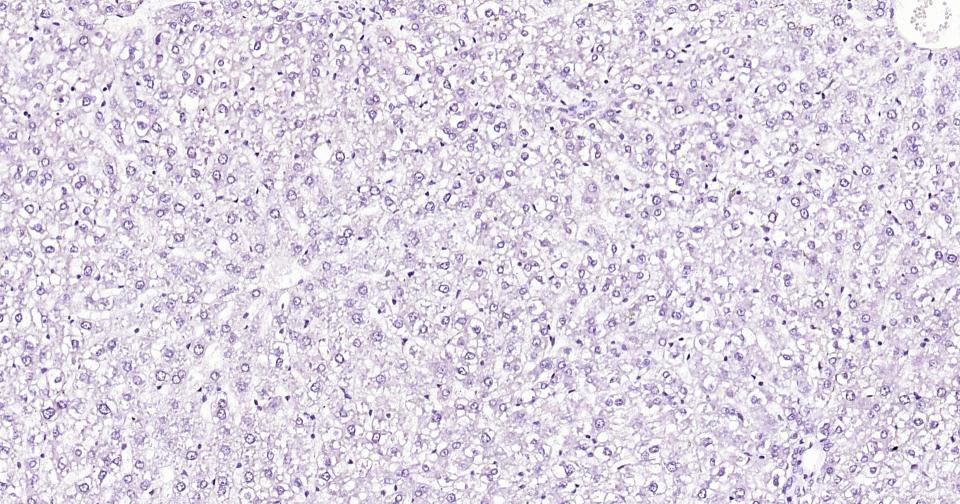 Anti-Alpha-fetoprotein Antibody (5G216)