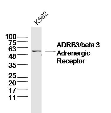 Anti-ADRB3 Polyclonal Antibody
