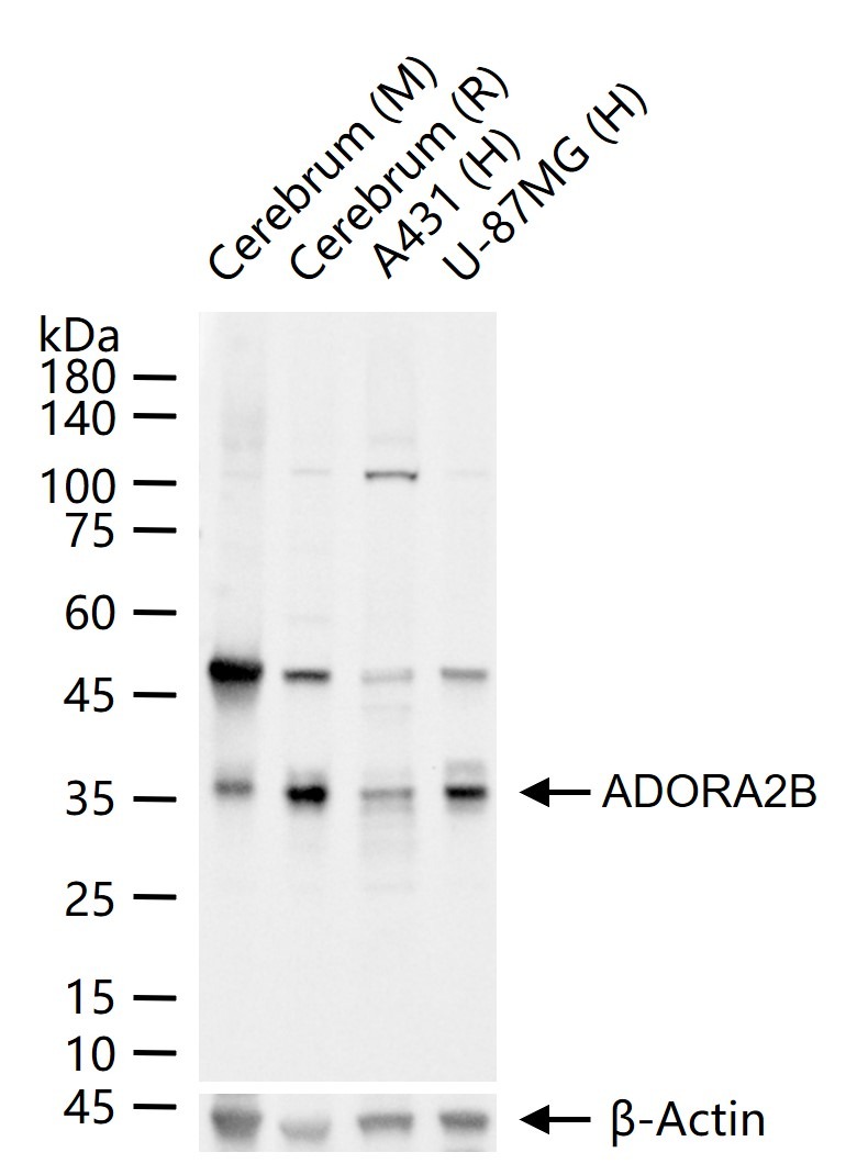 Anti-ADORA2B Polyclonal Antibody