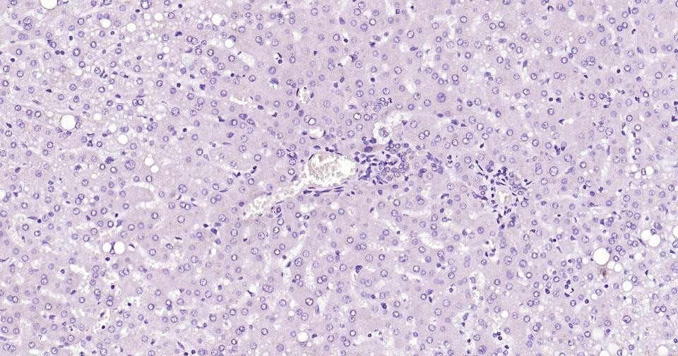 Anti-Alpha-fetoprotein Antibody (5G216)