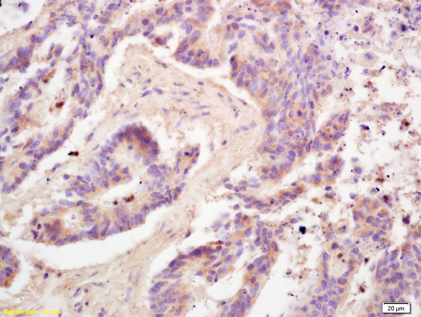 Anti-Adiponectin Polyclonal Antibody