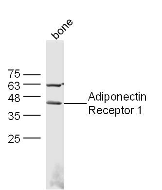 Anti-ADIPOR1 Polyclonal Antibody