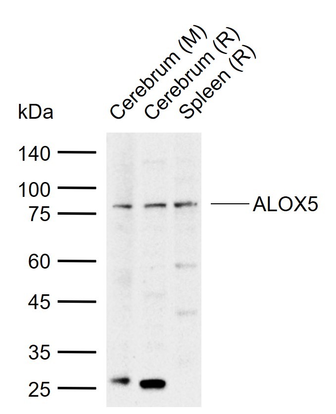 Anti-ALOX5 Polyclonal Antibody