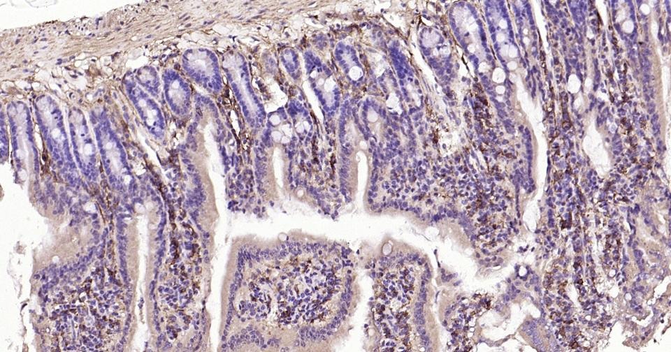 Anti-ADGRE1 Polyclonal Antibody 2